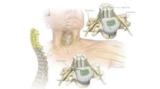 Cervical Spine Neurosurgery in Kolkata: Advanced Solutions for Neck Pain