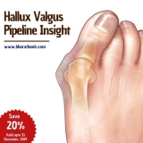 Hallux Valgus Development Activities – Pipeline Insight, 2019