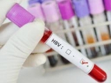 Global Hepatitis Test Solution/Diagnosis Market 2018 – Industry Overview, Insights, Investment