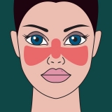 Lupus: Getting a diagnosis and finding treatment that works