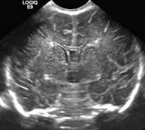 Neonatal Neurosonography Market Growth Prediction 2019 ( Siemens Healthcare,  Shimadzu, GE Healthcare and   Philips Healthcare)
