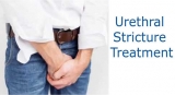 Urethral Stricture Treatment Market Size, Growth, Outlook, and Analysis, 2018 – 2026