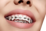 The Journey to a Perfect Smile: Orthodontic Procedures Demystified